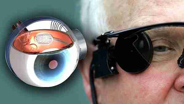 Neuralink-insan-beyni-ve-bilgisayarları-birleştirecek