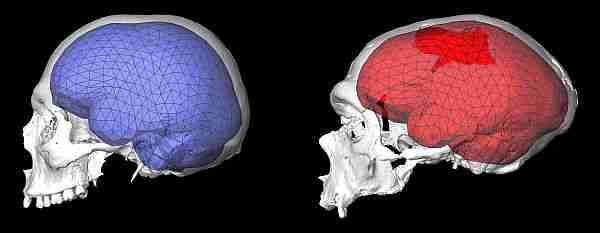 On-the-left-the-globular-endocranial-shape-of-a-modern-human-brian-and ...